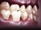 Mouth, teeth, gums. Sensitive teeth, withdrawal of the gingiva. Dental sensitivity.