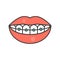 Mouth and teeth smile with braces, dental related icon, filled o
