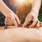 Moxibustion Therapy â€“ Traditional Chinese Medicine