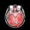 MRA (magnetic resonance angiography) of brain for stroke patient.