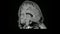 MRI Brain 3D Rotation