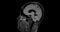 MRI  brain scan  sagittal flair for detect  Brain  diseases sush as stroke disease, Brain tumors and Infections