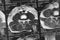 MRI image