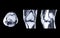 MRI Knee joint or Magnetic resonance imaging compare axial, coronal and sagittal view.