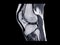 MRI Knee joint or Magnetic resonance imaging sagittal view.