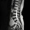 MRI L-s spine or MRI of lambosacral spine.