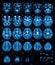 MRI (Magnetic resonance imaging) of the brain, transvers view, T2.