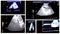 Multi screen Ultrasound baby in mother\'s womb