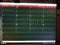 Multiple Green EKG Tracings on telemetry Monitor