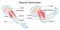 Muscle contraction mechanism. Muscles work principle scheme