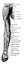 Muscles on the Back of the Arm Forearm and Hand vintage illustration