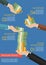 Mutual fund infographic concept