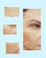 Mwoman face wrinkles before and after lifting removal cosmetic procedures, collage edicine, procedure