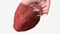 Myocardial Infarction Circumflex Artery . Heart attack