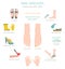 Nail diseases. Onychomycosis, nail fungal infection causes, treatment icon set. Medical infographic design