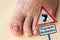 Nail fungus on the toenails and skin spots