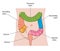 Names areas of the large intestine