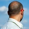 Nape of a mature balding man against the sky.