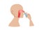 Nasal spray, profile of a man who is curing his running nose