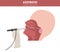 Nasal and throat, nasopharynx diseases. Adenoids diagnosis and treatment medical infographic design