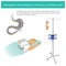 Nasogastric tube feeding by continuous controlled pump 25x25