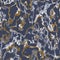 Navy blue yellow marbled seamless texture. Irregular color ink blotched paint effect background. Marble irregular swirl