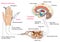 Nerve response to pain and touch