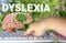 Neural Signature in human brain for Dyslexia, Disruption of Posterior Reading System, fingers on keyboard, concept of dyslexia