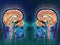 Neuroimaging or Brain Imaging