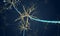 The Neuron with Degenerated Myelin