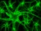 Neuron - nerve cell illustration