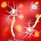 Neurons in the brain with Alzheimer`s disease, and amyloid plaques