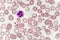 Neutrophil cell in blood smear