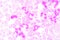 Neutrophils are a type of phagocyte and are normally found in th