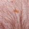 Nevus or mole on the human body close-up. Skin cancer, keratosis or melanoma on the skin