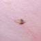 Nevus or mole on the skin of adult