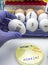 New H5N8 strain of avian influenza spread in humans, scientist with infected egg
