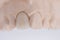 New white ceramic dentures on a light background