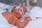 Newborn baby with hyperbilirubinemia on breathing machine with pulse oximeter sensor in neonatal intensive care unit at children`s