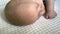 newborn baby's seborrhea skin problems allergy or rash on head and forehead
