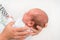 Newborn baby with skin rash. Allergic reaction after birth