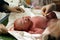 Newborn: cutting the umbilical cord