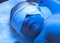 Newborn jaundice treatment