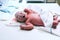 Newborn in nursery after childbirth.