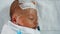 Newborn preterm infants under a dropper