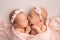 A newborn twins sleeps next to his sister. Newborn twin girls on the background of a pink blanket with pink bandages.