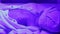 Newborn under ultraviolet lamp.