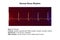 A normal electrocardiogram, 3D illustration