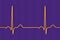 A normal electrocardiogram, 3D illustration displaying the electrical activity of the heart in a healthy individual,