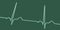 A normal electrocardiogram, 3D illustration displaying the electrical activity of the heart in a healthy individual,